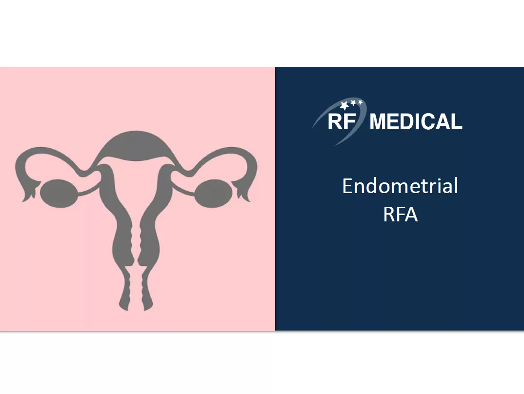 RF Medical - Endometrial RFA
